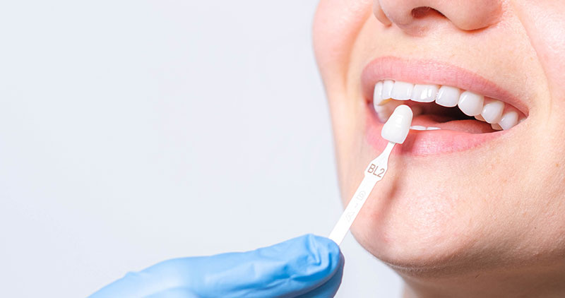 Enhancing Your Smile with Cosmetic Dentistry Procedures