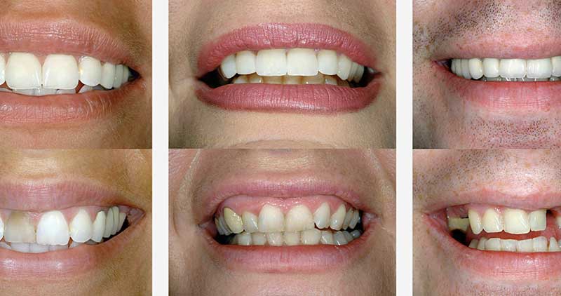 Smile Makeovers: What’s Possible with Modern Dentistry?