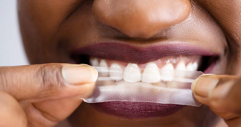 What Are Some of the Best Teeth Whitener Products on the Market?
