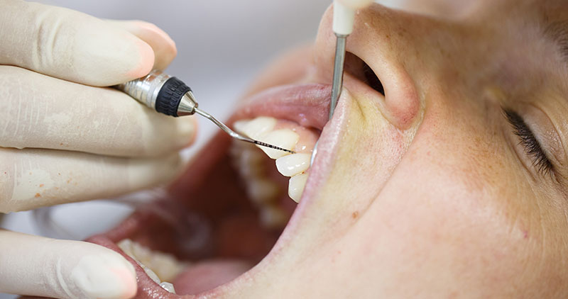 Periodontal Treatments: What You Need to Know