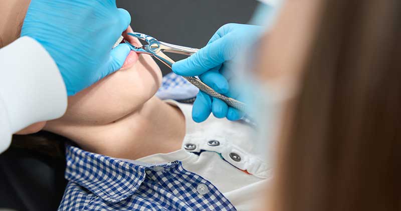 Recovery Tips After Tooth Extraction
